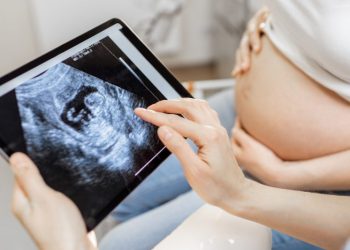 Antiabortion group’s ‘Baby Olivia’ video may be required in some schools