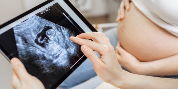 Antiabortion group’s ‘Baby Olivia’ video may be required in some schools