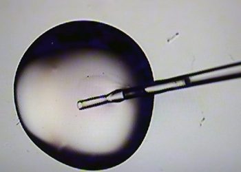 Republicans, pro-life advocates split on Trump’s proposal to federally subsidize IVF