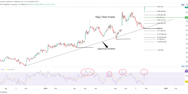 Top Stock Gainers & Losers: PRCT Stock +32%, PHG -16% Drop